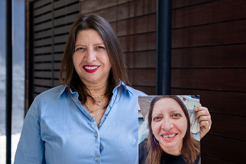 Sara, an ADHP implant patient, holding a photograph of her smile before treatment