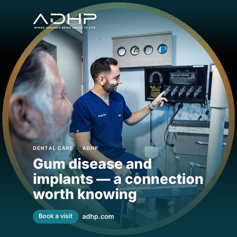 Gum disease and implants — a connection worth knowing
