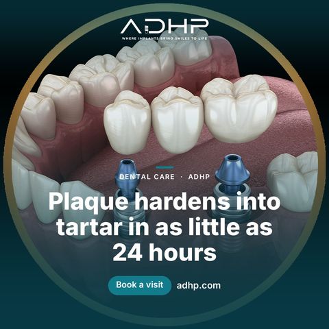 Plaque hardens into tartar in as little as 24 hours