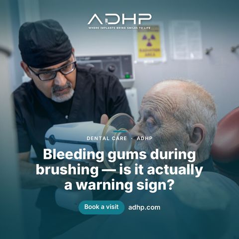 Bleeding gums during brushing — is it actually a warning sign?