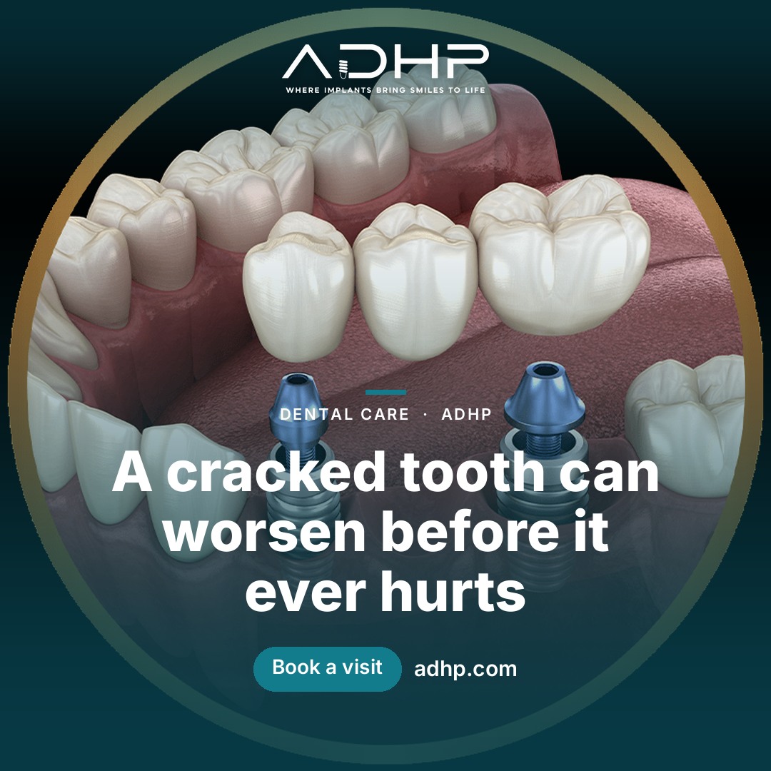 Signs You May Need a Dental Crown in Fallbrook, CA