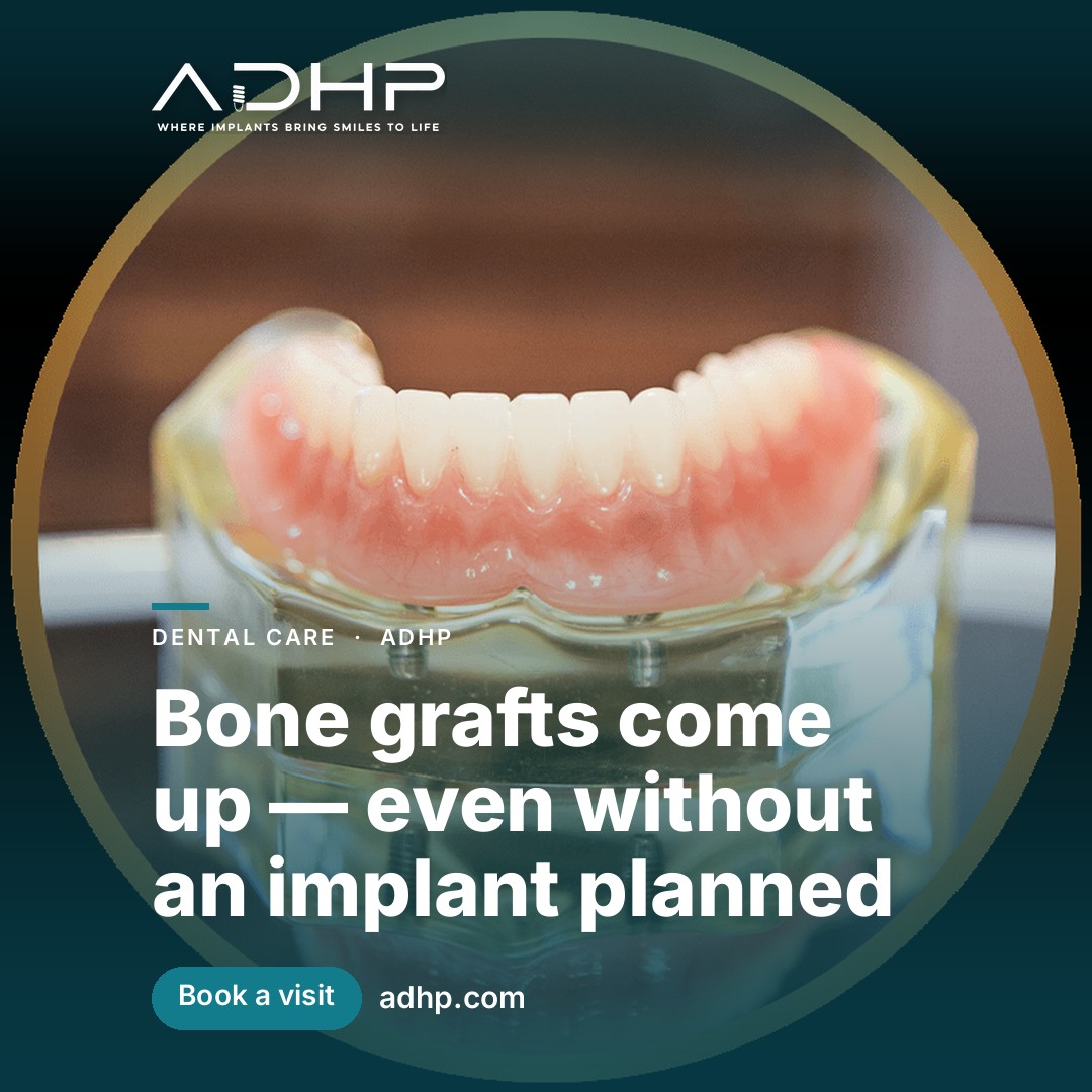 Bone grafts come up — even without an implant planned