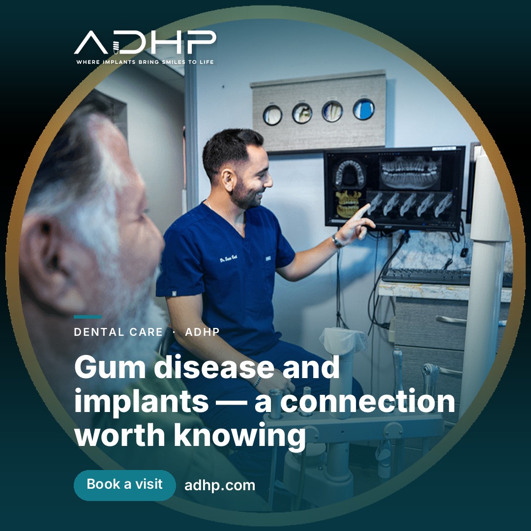 Gum disease and implants — a connection worth knowing