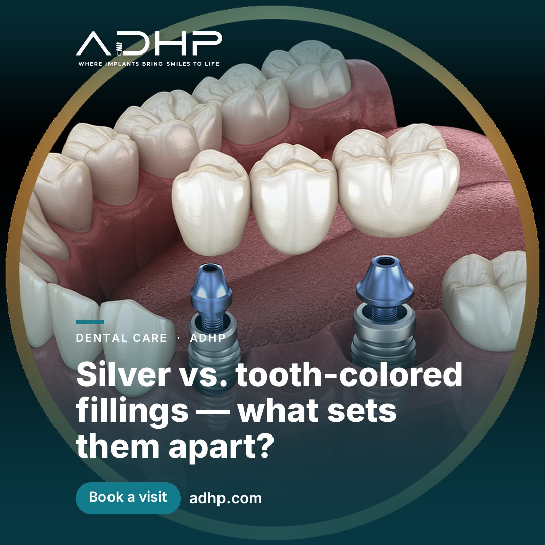 Silver vs. tooth-colored fillings — what sets them apart?